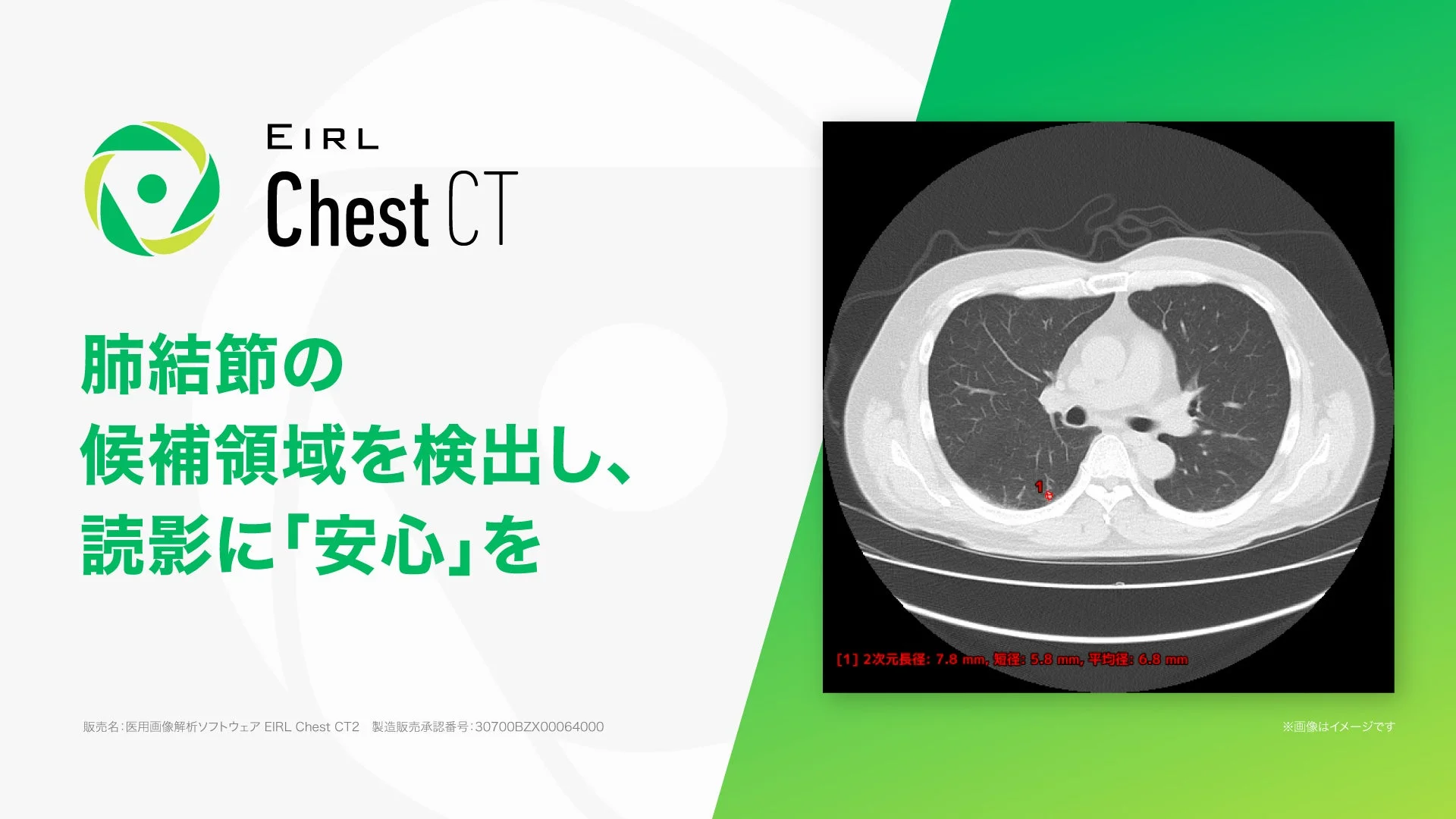 AIを活用した医用画像解析ソフトウェア「EIRL Chest CT」が、肺CT画像から肺結節の候補領域を検出し、医師の診断を支援する様子