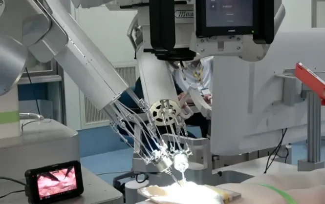 先進的なロボットアームが医療処置を行っている様子。複数のディスプレイで状況を監視しながら、精密な作業が進められており、最新の医療技術の活用を示唆しています。